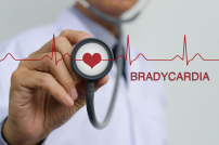 Брадикардия: симптомы и лечение